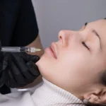 Altın İğne Zararları