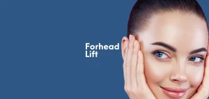 Forehead Lift