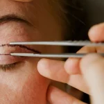 Tek Taraflı Göz Kapağı Düşüklüğü