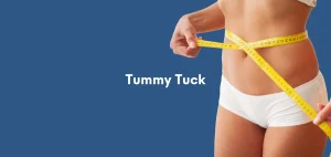Tummy Tuck