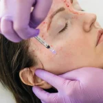 Vampir Tedavisi Nedir?